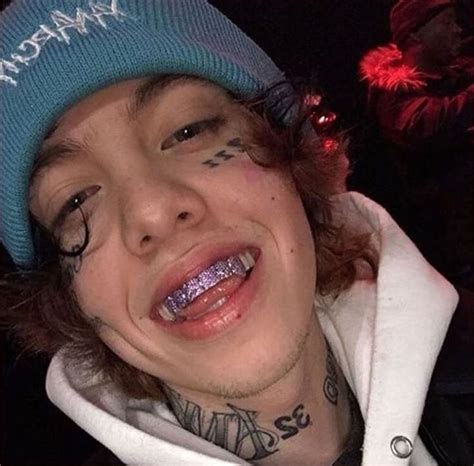 lil xan teeth